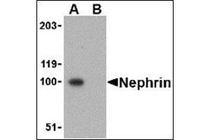 Western blot analysis in mouse kidney tissue lysate using Nephrin Antibody at 1 μg/ml in the (A) absence and (B) presence of blocking peptide. (Nephrin anticorps  (C-Term))