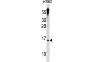 Western blot analysis in K562 cell line lysates (35ug/lane) using MAD3 Antibody (N-term). (MXD3 anticorps  (N-Term))