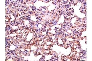 Formalin-fixed and paraffin embedded rat lung labeled with Anti-Sialoadhesin Polyclonal Antibody, Unconjugated  at 1:500 followed by conjugation to the secondary antibody and DAB staining (Sialoadhesin/CD169 anticorps  (AA 851-950))