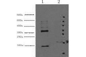 Western Blot analysis of 1) Hela, 2) 293T cells using CA9 Monoclonal Antibody at dilution of 1:5000. (CA9 anticorps)