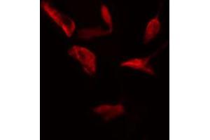ABIN6274756 staining HeLa cells by IF/ICC. (RPS4X anticorps  (Internal Region))