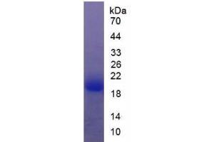 SDS-PAGE analysis of Rat Thyroid Peroxidase Protein. (Thyroperoxidase Protéine)