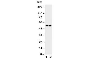 Western blot testing of GABA A Receptor alpha 1 antibody and Lane 1:  rat brain (GABRA1 anticorps  (C-Term))