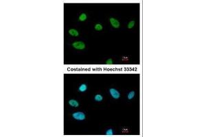 ICC/IF Image Immunofluorescence analysis of paraformaldehyde-fixed A549, using SOX2, antibody at 1:200 dilution. (SOX2 anticorps)