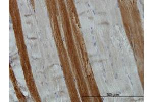 Image no. 1 for anti-Target of Myb 1 (TOM1) (AA 394-492) antibody (ABIN599110) (TOM1 anticorps  (AA 394-492))