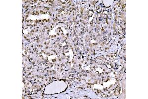 IHC analysis of CBX1/HP1 beta using anti-CBX1/HP1 beta antibody (ABIN7602012).