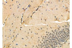 ABIN6258939 and ABIN6275384 at 1/100 staining Rat brain tissue by IHC-P.