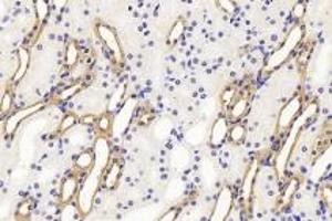 Immunohistochemistry analysis of paraffin-embedded mouse kidney using Endostatin (ABIN7073823) at dilution of 1:1200 (COL18A1 anticorps)