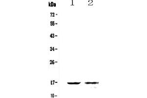 Western blot analysis of Galectin 10 using anti-Galectin 10 antibody . (Galectin 10 anticorps  (AA 2-142))