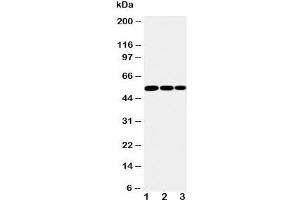 Western blot testing of IKK gamma antibody and Lane 1:  mouse liver;  2: mouse brain;  3: mouse ovary tissue lysate.