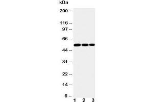 Western blot testing of IKK gamma antibody and Lane 1:  mouse liver;  2: mouse brain;  3: mouse ovary tissue lysate.