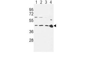 Western Blotting (WB) image for anti-Chemokine (C-C Motif) Receptor 7 (CCR7) antibody (ABIN3002197) (CCR7 anticorps)