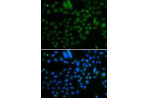 Immunofluorescence analysis of A549 cells using ALKBH8 antibody.