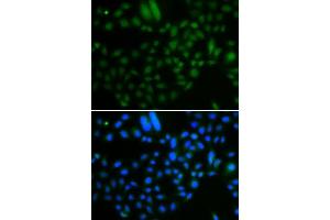 Immunofluorescence analysis of A549 cells using ALKBH8 antibody. (ALKBH8 anticorps  (AA 1-230))