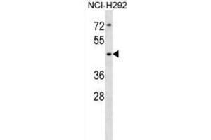 Western Blotting (WB) image for anti-Sialic Acid Binding Ig-Like Lectin 14 (SIGLEC14) antibody (ABIN5018304) (SIGLEC14 anticorps)