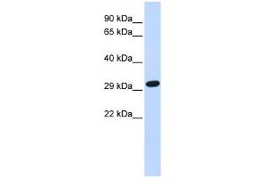 SDCBP antibody used at 1 ug/ml to detect target protein.