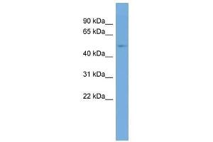 TRMT6 antibody used at 0. (TRMT6 anticorps  (Middle Region))