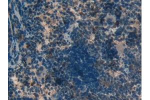 Detection of ND5 in Rat Spleen Tissue using Polyclonal Antibody to NADH Dehydrogenase 5 (ND5)