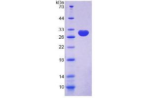 SDS-PAGE analysis of Human C/EBP delta Protein. (CEBPD Protéine)