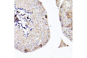 Immunohistochemistry of paraffin-embedded Mouse testis using S antibody (ABIN7270138) at dilution of 1:200 (40x lens).