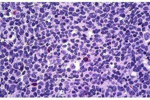 Anti-PPP3CA / Calcineurin A antibody IHC of human tonsil, lymphocytes.