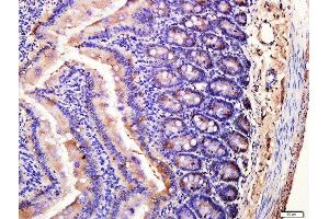 Paraformaldehyde-fixed, paraffin embedded mouse small intestine tissue, Antigen retrieval by boiling in sodium citrate buffer(pH6) for 15min, Block endogenous peroxidase by 3% hydrogen peroxide for 30 minutes, Blocking buffer (normal goat serum) at 37°C for 20min, Antibody incubation with Rabbit Anti-SLC11A2 Polyclonal Antibody, Unconjugated  at 1:400 overnight at 4°C, followed by a conjugated secondary and DAB staining
