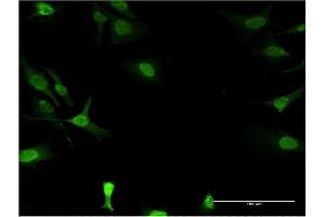 Immunofluorescence of monoclonal antibody to DCK on HeLa cell.