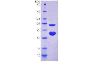 SDS-PAGE (SDS) image for Arginine Vasopressin Induced Protein 1 (AVPI1) (AA 13-148) protein (His tag) (ABIN6239507) (AVPI1 Protein (AA 13-148) (His tag))