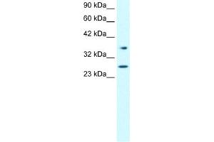 WB Suggested Anti-FOXA3 Antibody Titration:  0. (FOXA3 anticorps  (Middle Region))