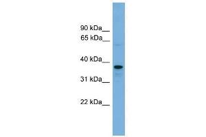 VPS16 antibody used at 0. (VPS16 anticorps  (N-Term))