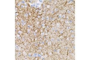 Immunohistochemistry of paraffin-embedded mouse brain using NTF3 antibody.