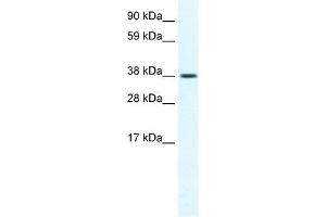 TRPM3 antibody used at 1. (TRPM3 anticorps  (N-Term))