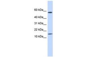 KRTAP11-1 anticorps  (N-Term)