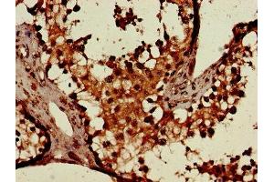 Immunohistochemistry of paraffin-embedded human testis tissue using ABIN7154406 at dilution of 1:100 (CSF2RA anticorps  (AA 23-320))