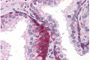 Anti-TRAF6 antibody IHC staining of human prostate. (TRAF6 anticorps  (AA 194-378))