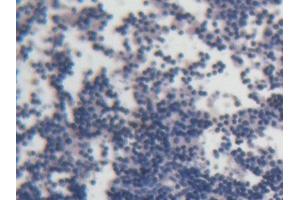 DAB staining on IHC-P; Samples: Rat Lymph node Tissue (ACP6 anticorps  (AA 33-413))