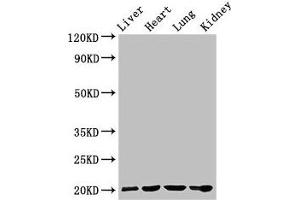 Western Blot Positive WB detected in: Rat liver tissue, Mouse heart tissue, Mouse lung tissue, Mouse kidney tissue All lanes: GPIHBP1 antibody at 4 μg/mL Secondary Goat polyclonal to rabbit IgG at 1/50000 dilution Predicted band size: 20 kDa Observed band size: 20 kDa (GPIHBP1 anticorps  (AA 21-151))