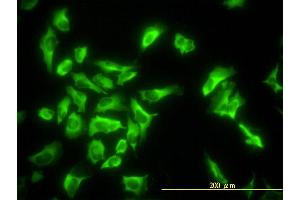 Immunofluorescence of monoclonal antibody to EEF1G on HeLa cell. (EEF1G anticorps  (AA 1-437))
