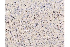 IHC analysis of PMPCA/INPP5 using anti-PMPCA/INPP5 antibody (ABIN7602722). (PMPCA anticorps  (AA 99-525))