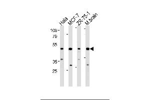 Western blot analysis in Hela,MCF-7,ZR-75-1 cell line and mouse brain lysates (35ug/lane). (FBXO28 anticorps  (C-Term))