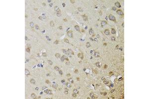 Immunohistochemistry of paraffin-embedded rat brain using CHN1 antibody (ABIN5974737) at dilution of 1/100 (40x lens). (CHN1 anticorps)