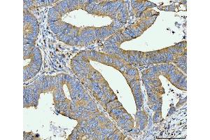 IHC analysis of FACL4/ACSL4 using anti-FACL4/ACSL4 antibody (ABIN7602779).