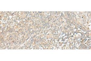 Immunohistochemistry of paraffin-embedded Human tonsil tissue using BEX2 Polyclonal Antibody at dilution of 1:45(x200) (BEX2 anticorps)