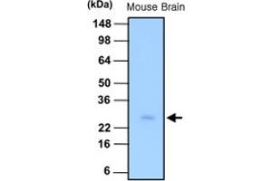 Western blot analysis of tissue lysate of mouse brain (30 ug) was resolved by SDS - PAGE , transferred to PVDF membrane and probed with PSPH monoclonal antibody , clone 3G12 (1 : 1000) . (PSPH anticorps)