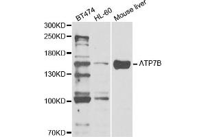 Western blot analysis of extracts of various cell lines, using ATP7B antibody. (ATP7B anticorps)