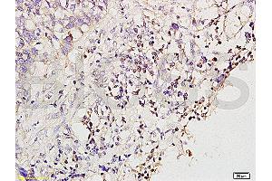 Formalin-fixed and paraffin embedded rat brain tissue labeled with Anti-MGMT Polyclonal Antibody (ABIN730768), Unconjugated at 1:200 followed by conjugation to the secondary antibody and DAB staining (MGMT anticorps  (AA 101-207))