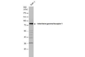 WB Image Interferon gamma Receptor 1 antibody detects Interferon gamma Receptor 1 protein by western blot analysis. (IFNGR1 anticorps)