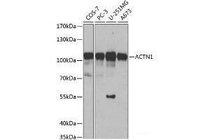 Western blot analysis of extracts of various cell lines using ACTN1 Polyclonal Antibody at dilution of 1:500. (ACTN1 anticorps)