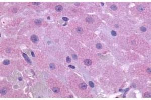 Immunohistochemical (Formalin/PFA-fixed paraffin-embedded sections) staining in human ovary with PTGFR polyclonal antibody . (PTGFR anticorps  (2nd Extracellular Domain))