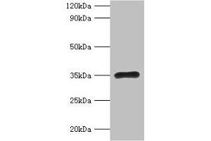 Western blot All lanes: RPL5 antibody at 2 μg/mL + EC109 whole cell lysate Secondary Goat polyclonal to rabbit IgG at 1/15000 dilution Predicted band size: 35 kDa Observed band size: 35 kDa (RPL5 anticorps  (AA 2-297))